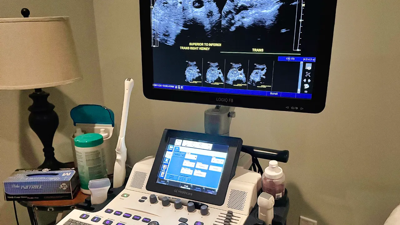 Erdoğan sets target of 700 domestic ultrasound devices a year; Türeci and Şahin receive Aziz Sancar award